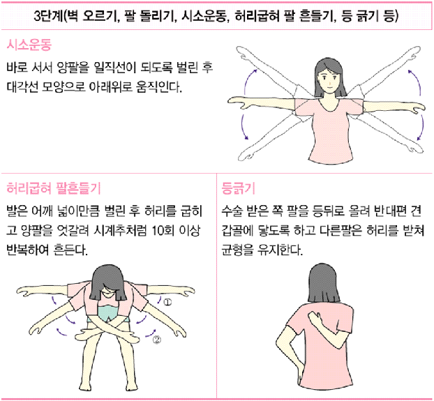 3단계(벽오르기, 팔돌리기, 시소운동, 허리굽혀 팔 흔들기, 등 긁기등)
시소운동 - 바로서서 양팔을 일직선이 되도록 벌린 후 대각선 모양으로 아래위로 움직인다.
허리굽혀 팔흔들기 - 발은 어깨 넓이만큼 벌린 후 허리를 굽히고 양팔을 엇갈려 시계추처럼 10회 이상 반복하여 흔든다. 
등긁기 - 수술 받은 쪽 팔을 등뒤로 올려 반대편 견갑골에 닿도록 하고 다른팔은 허리를 받쳐 균형을 유지한다.