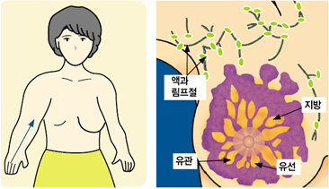 액과 림프절, 지방, 유관, 유선