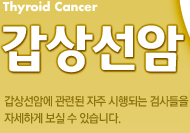 갑상선암 - 갑상선암에 관련된 자주 시행되는 검사들을 자세하게 보실 수 있습니다.